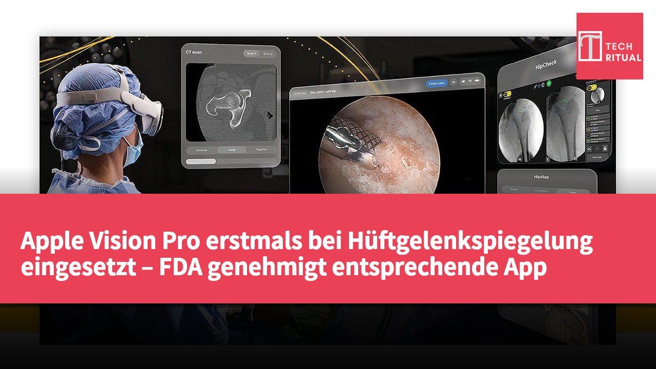 Apple Vision Pro erstmals bei Hüftgelenkspiegelung eingesetzt – FDA genehmigt entsprechende App
