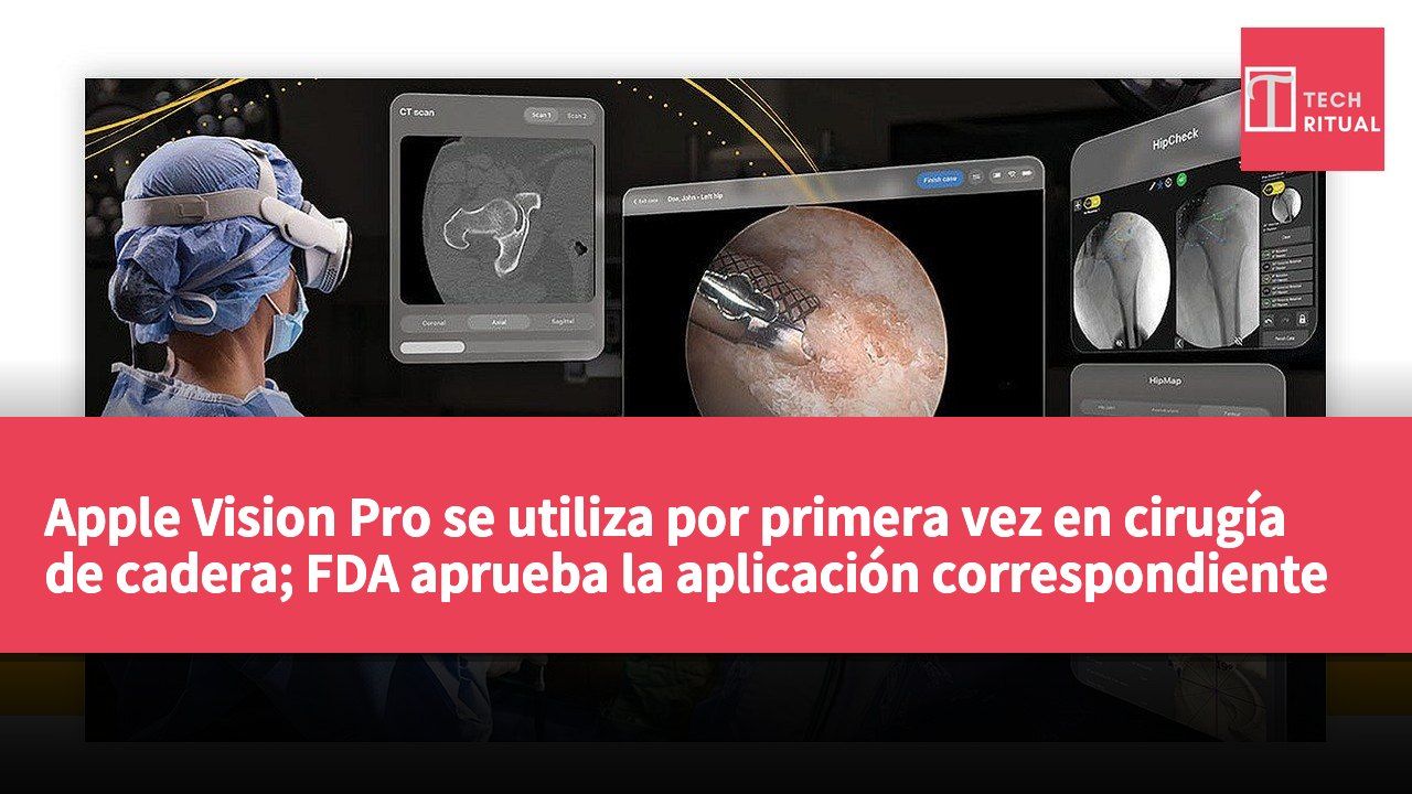 Apple Vision Pro se utiliza por primera vez en cirugía de cadera; FDA aprueba la aplicación correspondiente