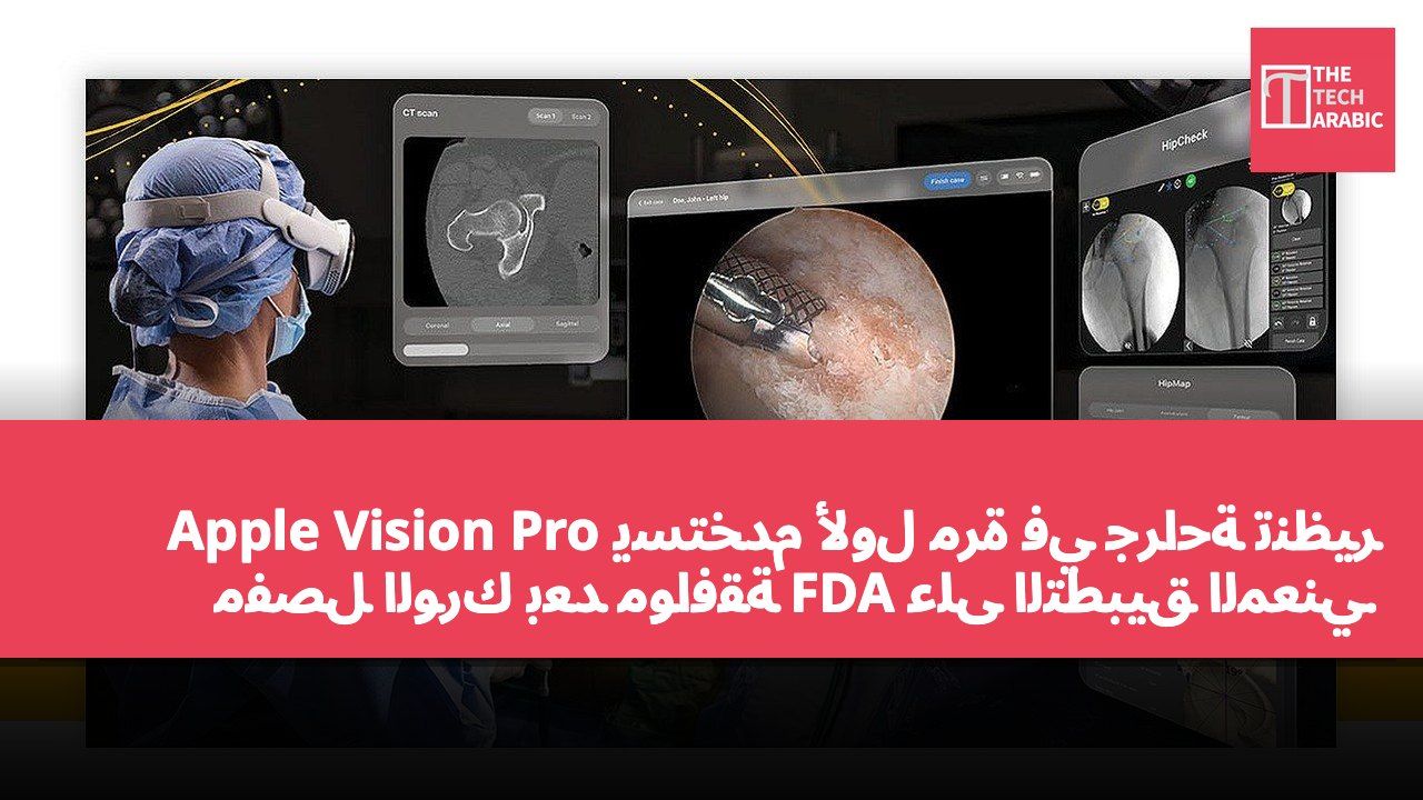 Apple Vision Pro يُستخدم لأول مرة في جراحة تنظير مفصل الورك بعد موافقة FDA على التطبيق المعني.