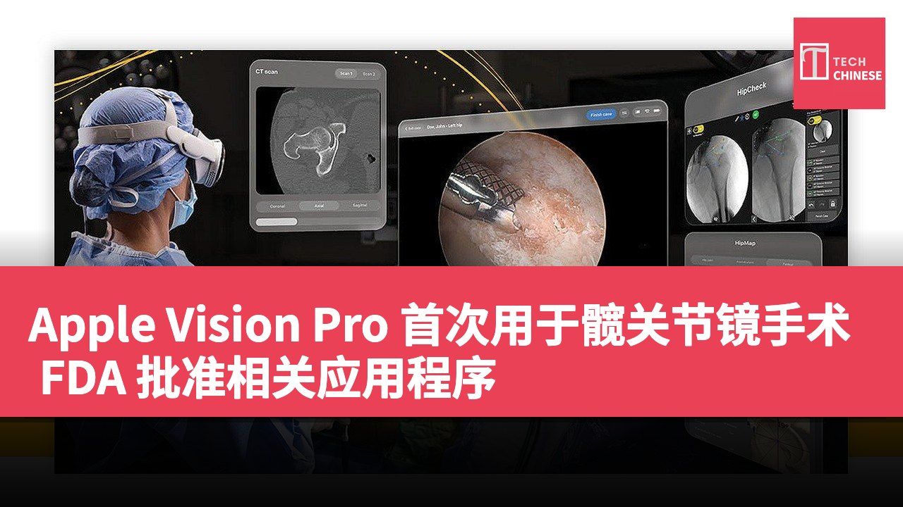 Apple Vision Pro 首次用于髋关节镜手术 FDA 批准相关应用程序